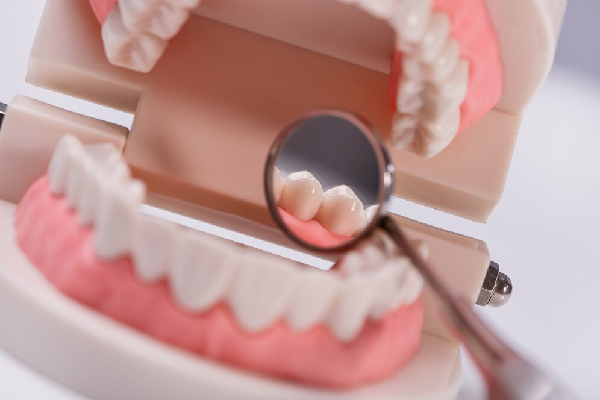 Teeth Scaling
