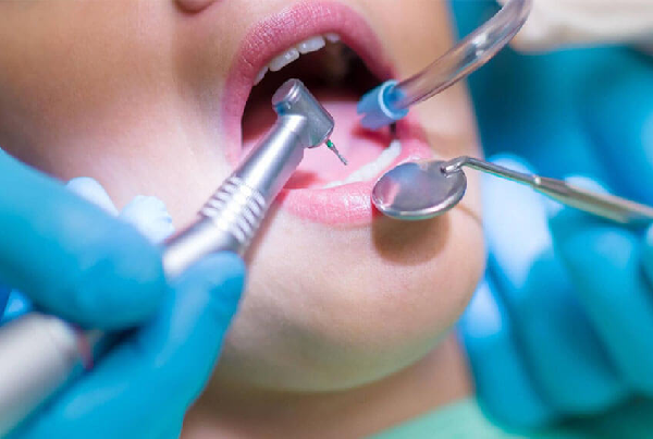 Minor Oral Surgeries